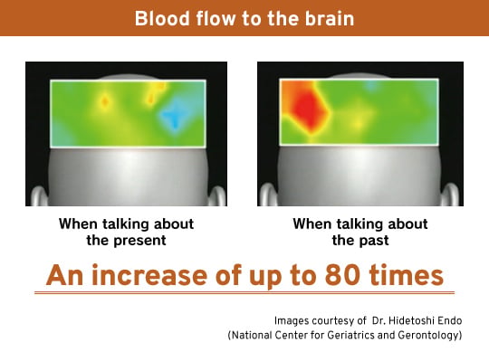 NHK RL Blood Flow NHK RL Blood Flow